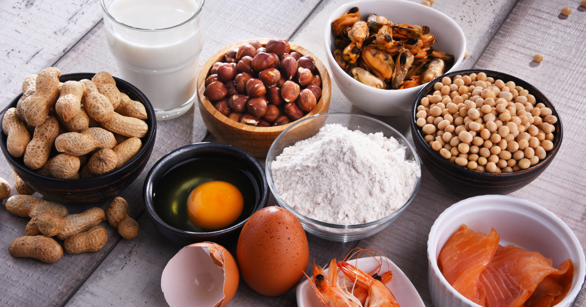 Food Allergies Omaha, NE Nebraska Medicine